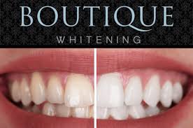 teeth whitening windsor professional