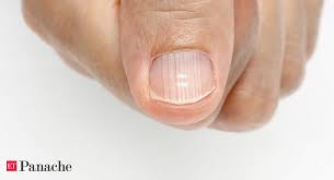 nails infections anemia psoriasis