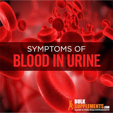 blood in urine symptoms causes and