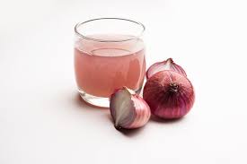 onion juice for dandruff efficacy