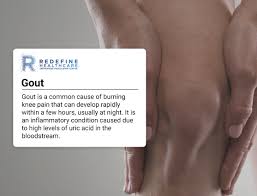 7 causes of burning knee pain nj s