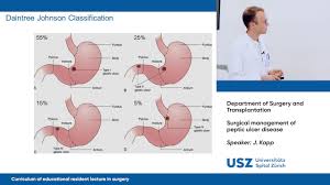 surgical management of peptic ulcer