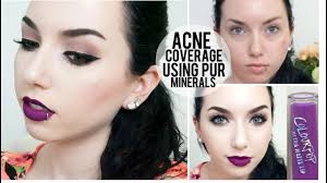 acne coverage pur minerals