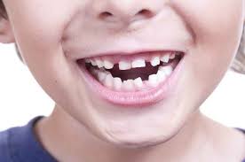 Umumnya pertumbuhan gigi (munculnya gigi), pada bayi dimulai ketika sang buah hati menginjak usia 4 bulan, namun ada juga yang agak terlambat dan mulai tumbuh di usia 6 bulan. Merawat Kesehatan Bayi Dimulai Dari Gigi Susu Alodokter