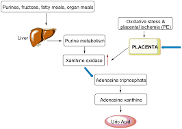 The Role Of Uric Acid In Preeclampsia Is Uric Acid A