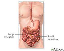 intestinal obstruction repair