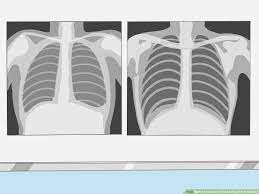 Best way to xray pictures. 8 Ways To Know If A Chest X Ray Film Is Rotated Wikihow