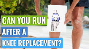 can you run after a knee replacement
