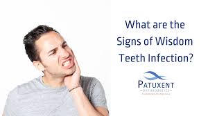 what are the signs of wisdom teeth