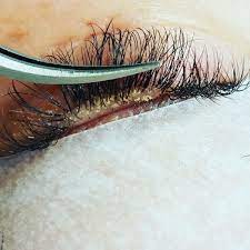 Seemingly normal aches and pains in your legs could be a sign of serious dvt. How To Clean Your Lash Extensions