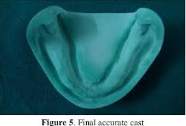 They are beautiful but most of them do not come with directions. A New Hybrid Technique For Beading And Boxing Of Complete Denture Final Impressions Semantic Scholar