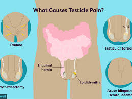 Dull ache in the lower abdomen or groin. Testicle Pain Cause And Treatment
