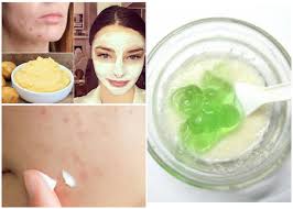 how to get rid of acne scars fast at