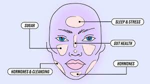 face mapping what do your spots mean