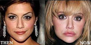 brittany murphy plastic surgery before