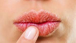 allergic reactions on the lips causes