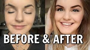 MICROBLADING MY EYEBROWS | Day 1 to Day 10 | My Experience & Advice -  YouTube