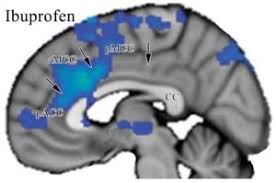 anterior cingulate cortex pain