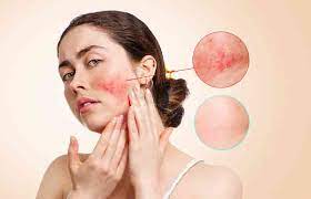 silicone for skin benefits how to use