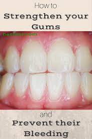 Quinones, past president of you can wear down your enamel if you brush too fast and hard. How To Strengthen Your Gums And Prevent Their Bleeding Herbiol Gum Health Receding Gums Grow Back Receding Gums