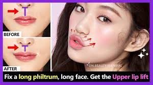 long philtrum get the upper lip lift