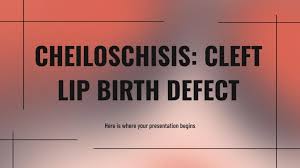 cheiloschisis cleft lip birth defect
