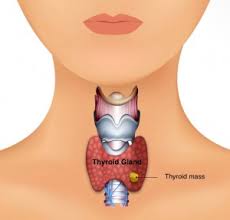 thyroid disease otolaryngology