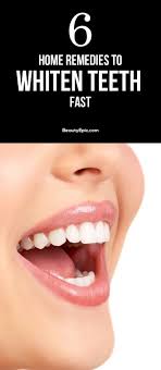 Simply read ahead to know about the how to whiten teeth at the most simple and doable home remedy for having beautiful white teeth is brushing your teeth daily, at least twice! Pin Auf Pin