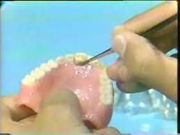 broken complete denture tooth