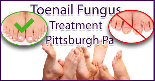 toenail fungus removal near pittsburgh