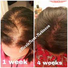 For best results warm the cbd oil up in hot water and massage into your scalp for 5. How To Use Hemp Oil For Hair Loss