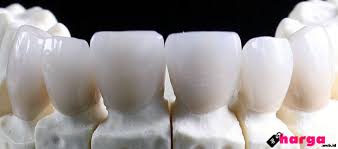 Namun berikut adalah antara senarai klinik kerajaan yang menawarkan perkhidmatan veneer gigi: Update Info Harga Tanam Implan Gigi Depan Permanen Daftar Harga Tarif
