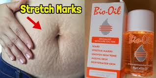 How to apply bio oil for face. How To Use Bio Oil For Wrinkles And Stretch Marks Imbb