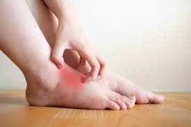5 tips to relieve foot eczema piedréseau