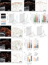 Forces generated by lamellipodial actin filament elongation regulate the  WAVE complex during cell migration | Nature Cell Biology