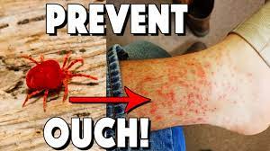 how long do chiggers live on clothes