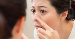 Even if you have a lot of whiteheads on your nose and chin, you should be able. Whiteheads On The Nose How To Get Rid Of Them