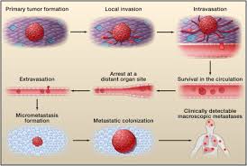 tumor metastasis molecular insights