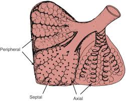 respiratory disease