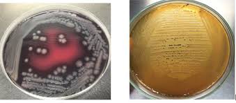 Salmonella typhimurium on xld agar. Salmonella Culture Morphology On Ss Agar And Xld Agar Download Scientific Diagram