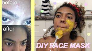 diy face mask to get rid of acne