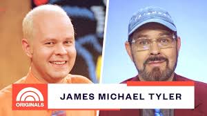 He was originally an extra on friends but was cast as gunther because he was the only one who knew how to operate an espresso machine. Where Is Gunther From Friends Now James Michael Tyler In 2021