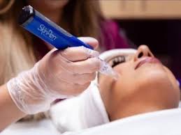 Microneedling with SkinPen - Med Spa Tempe AZ