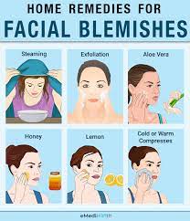 10 home remes for blemishes