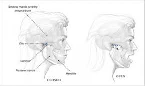 Tmj Temporomandibular Joint And Muscle Disorders Causes