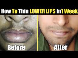 get slim lips naturally