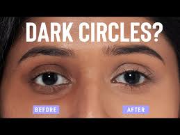 home remes to remove dark circles