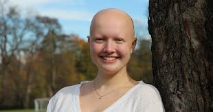 It may be congenital or acquired, circumscribed or diffuse, and cicatricial or nonscarring. Living With Alopecia A Young Woman S Path To Self Acceptance Get Healthy Stay Healthy