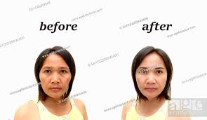 asian middle aged woman before and