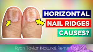 horizontal ridges on nails cause